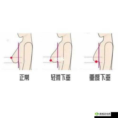 20 岁胸又软又下垂,正常吗?